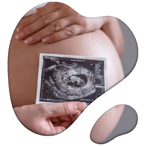 servicios-de-ginecologia-y-obstetricia-en-san-luis-potosi.png